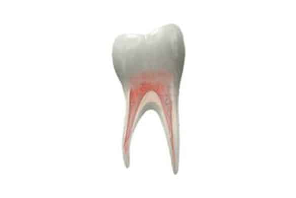 Common-endodontic-procedures