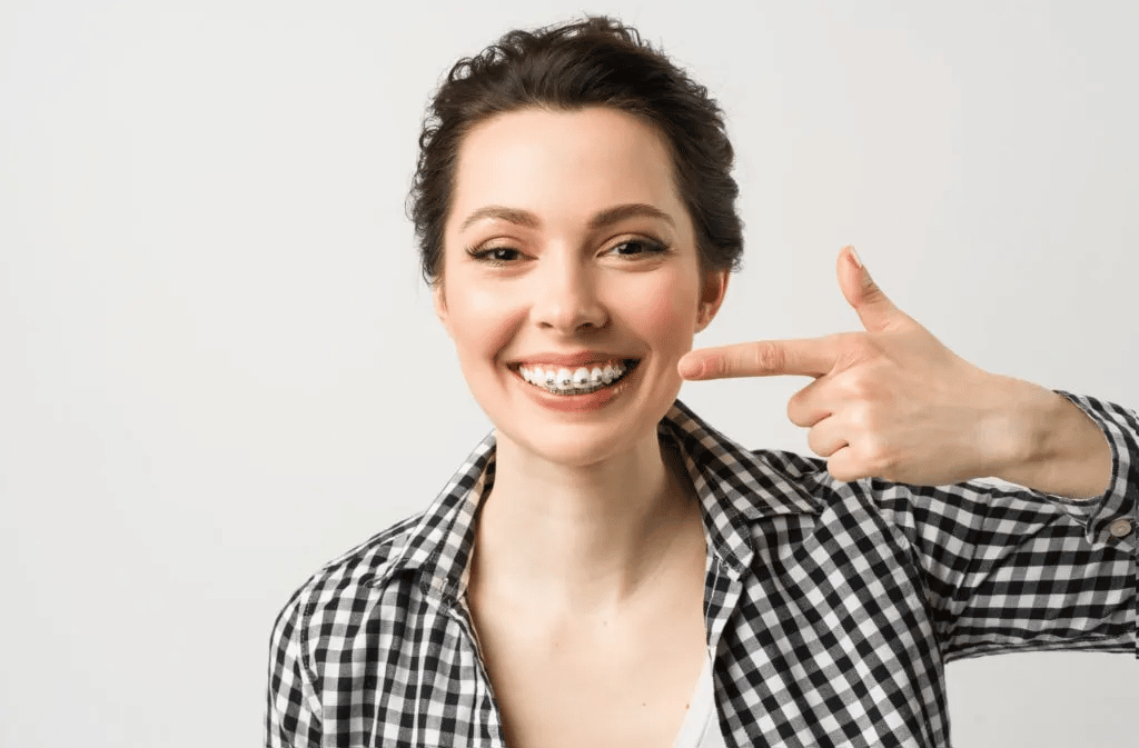 Metal-Braces
