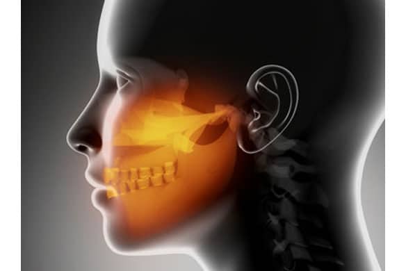 Orthognathic-surgery