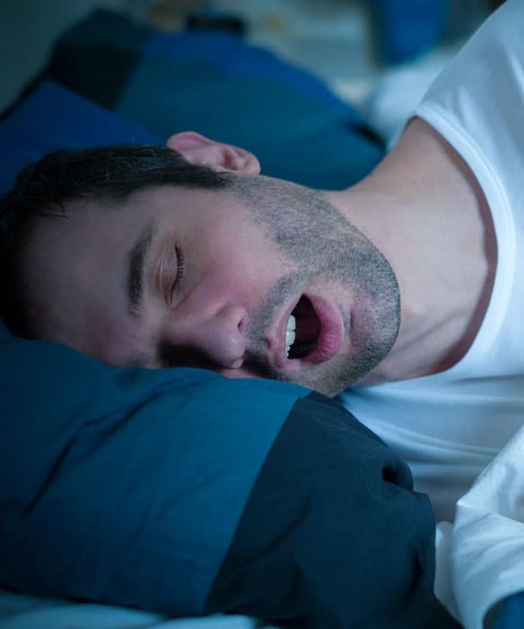 Types-of-Sleep-Apnea