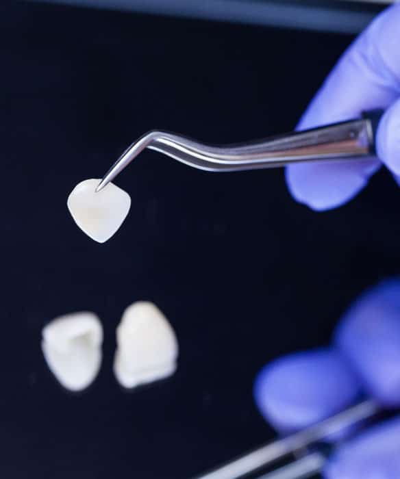 Dental-work-and-service-life (2)