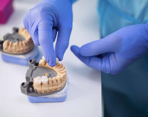 img-Dental-work-and-service-life