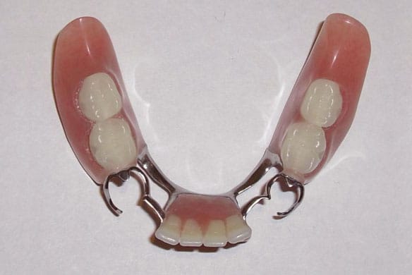 img-Partial-Denture