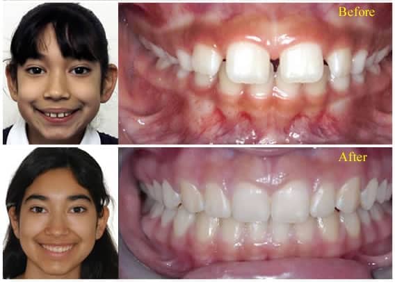 smile-ortho-1