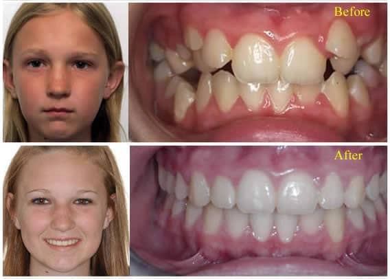smile-ortho-2