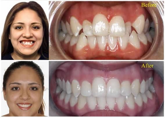 smile-ortho-3