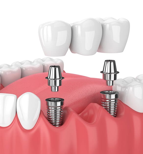 Restorative Dentistry