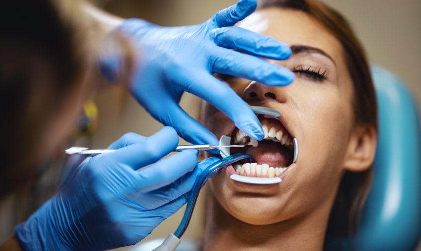 Dental Bonding in Avondale