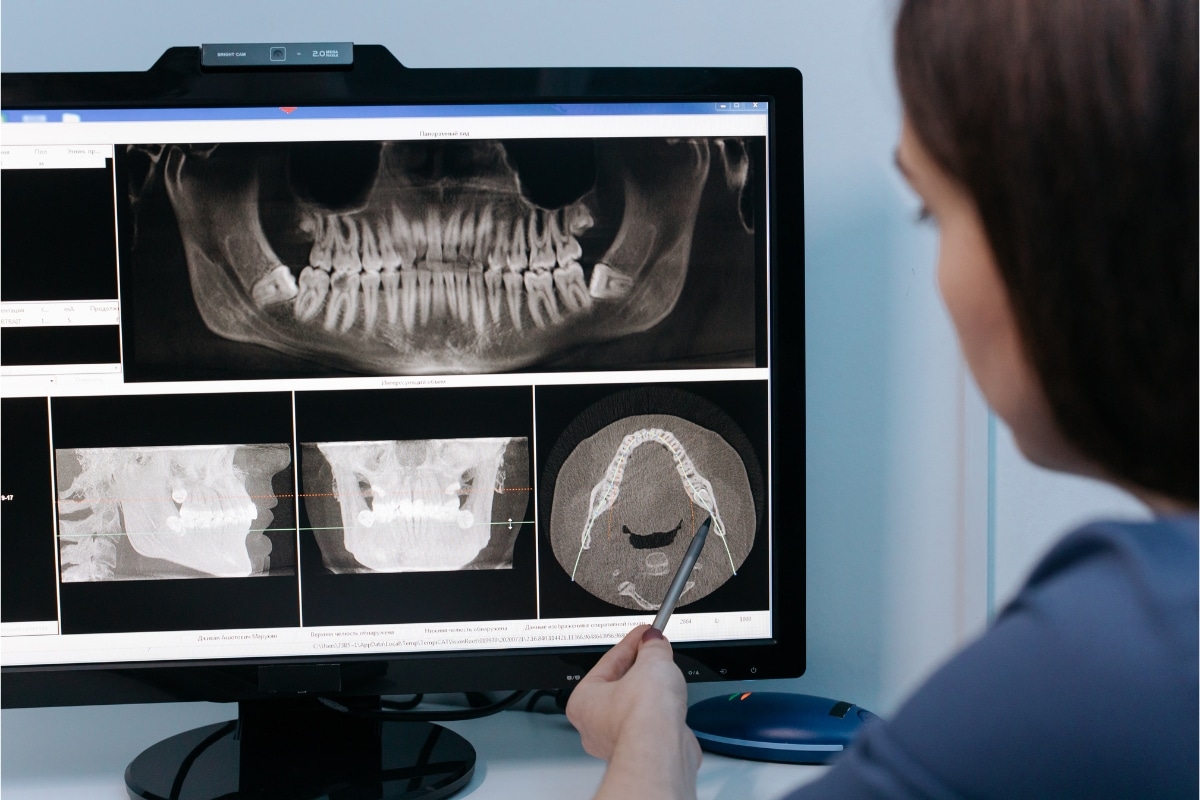 preventing dental emergency in Avondale, AZ - Gentle Family Dentist Avondale and Dental Implants