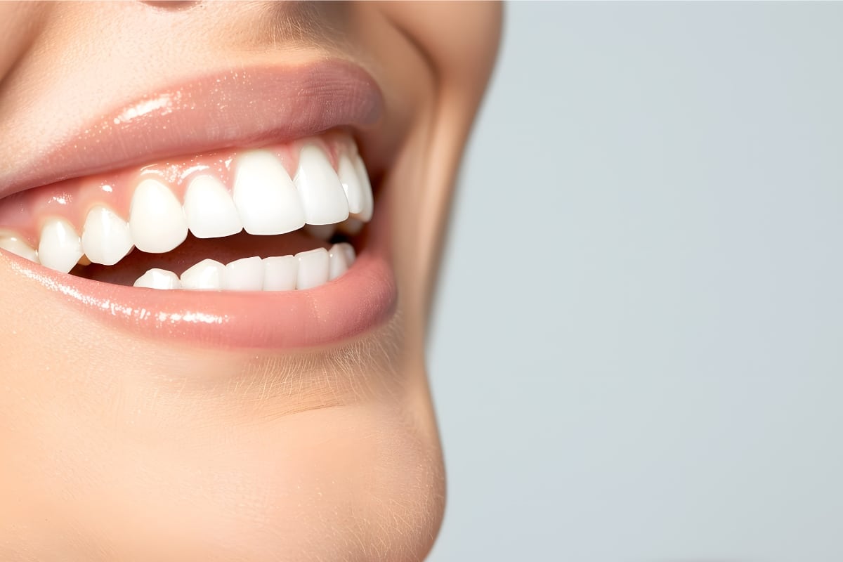 After Cosmetic Dentistry in Avondale, AZ - Gentle Family Dentist Avondale and Dental Implants