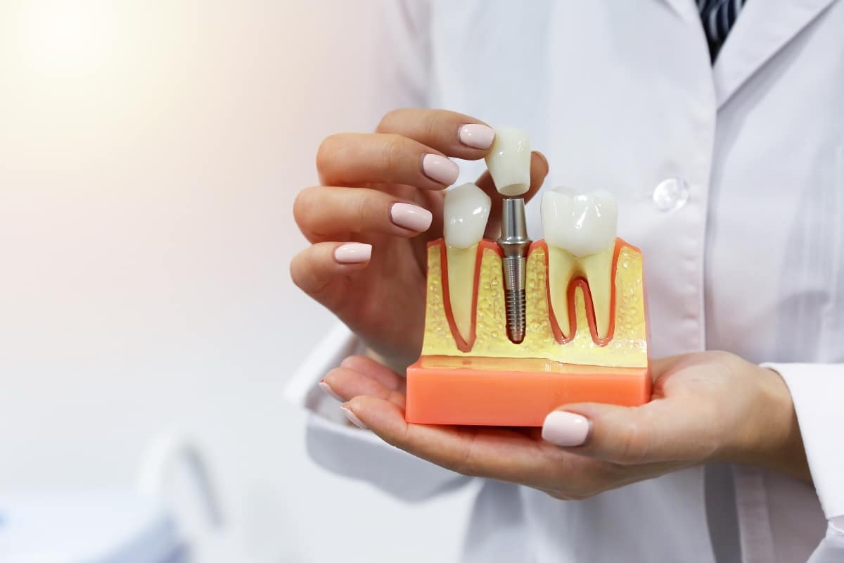 home-care-tips-dental-implants