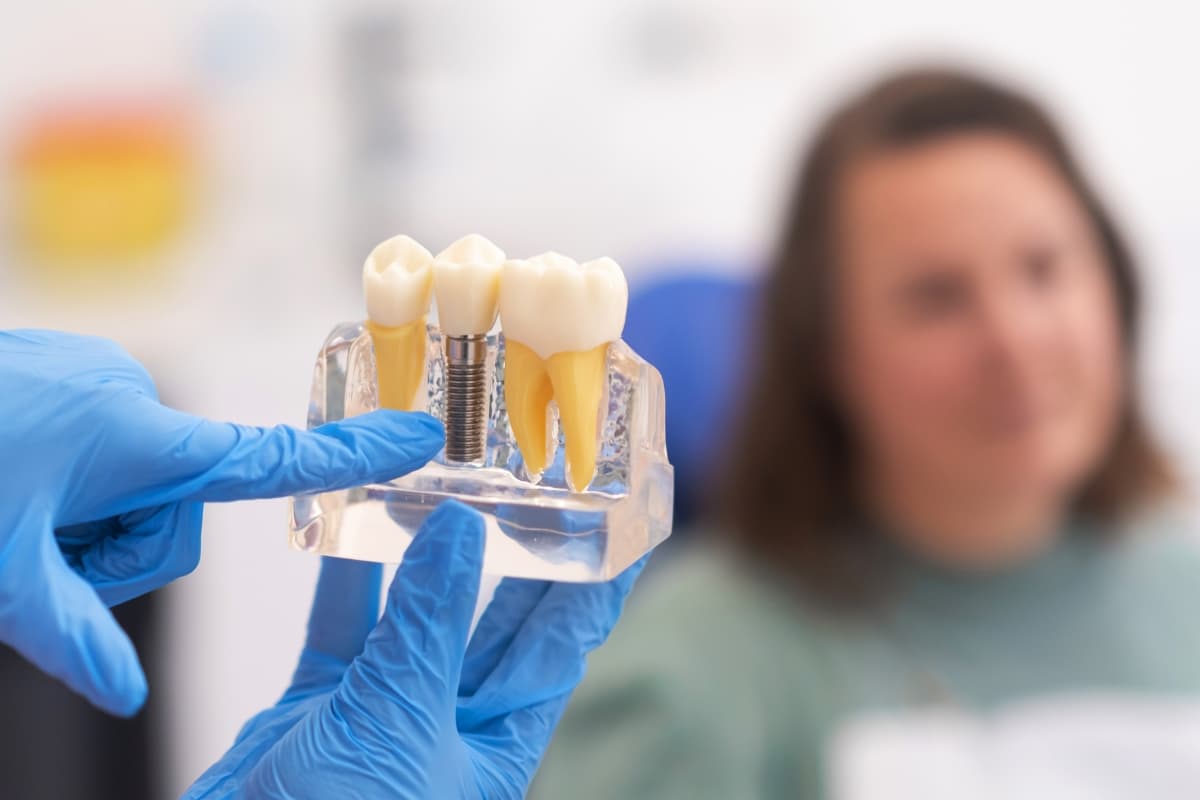 dental-implant-longevity