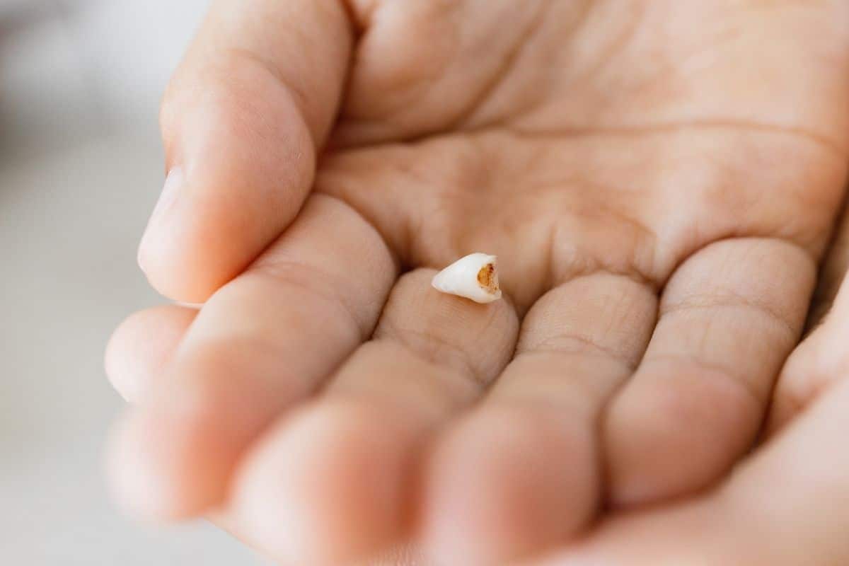 Featured image for “Don’t Make These Mistakes When a Tooth Gets Knocked Out”