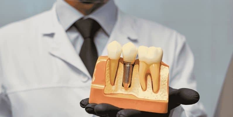 Signs of Dental Implant Failure