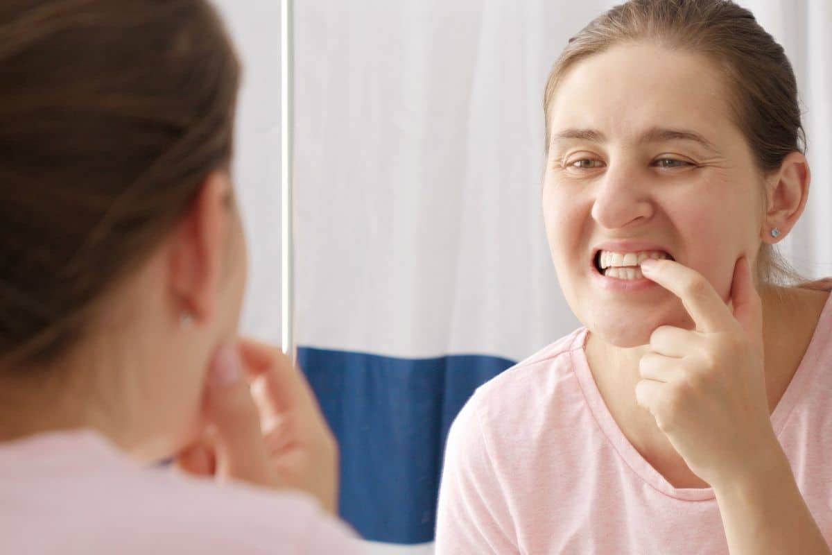 Featured image for “Why Do Some People Get White Spots After Teeth Whitening?”