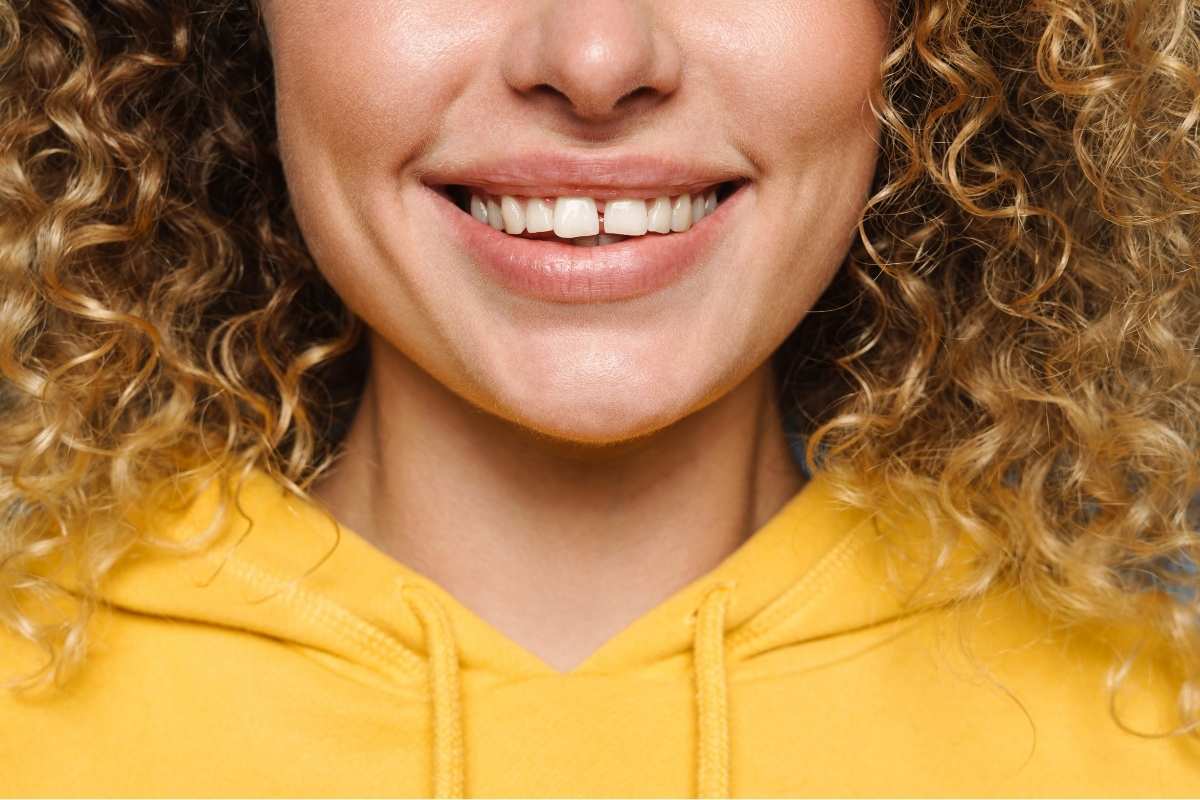 Cosmetic Dentistry for Close Gaps
