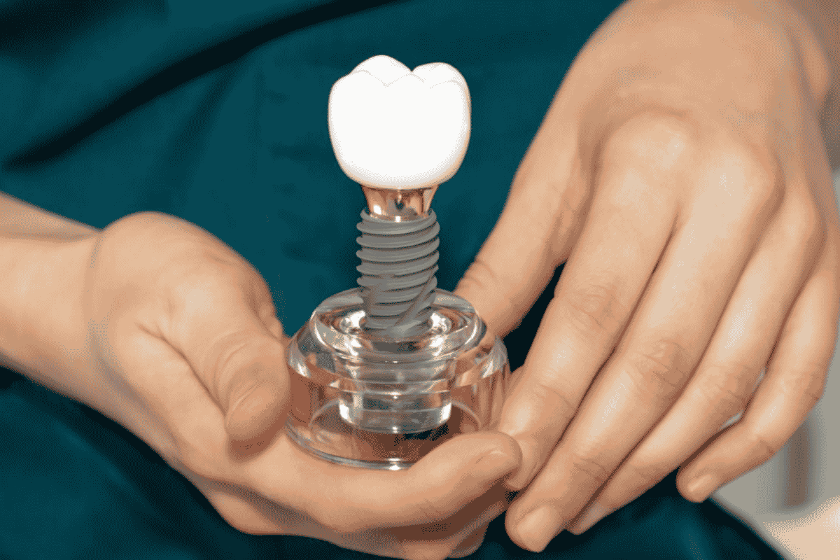 Featured image for “Can You Get Dental Implants Years After Losing a Tooth?”