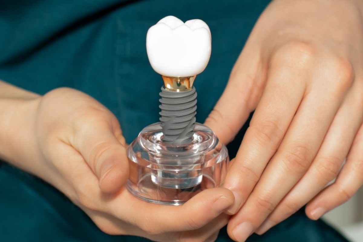 Featured image for “What to Eat After Dental Implant Surgery: A Complete Recovery Guide”